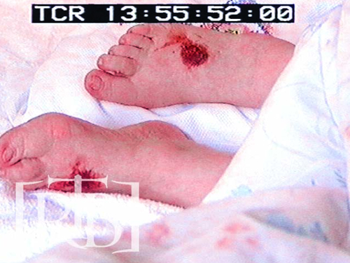 The Stigmata
